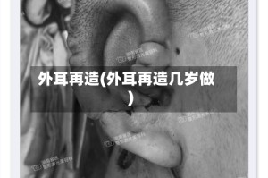 外耳再造(外耳再造几岁做)