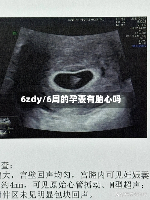 6zdy/6周的孕囊有胎心吗-第2张图片