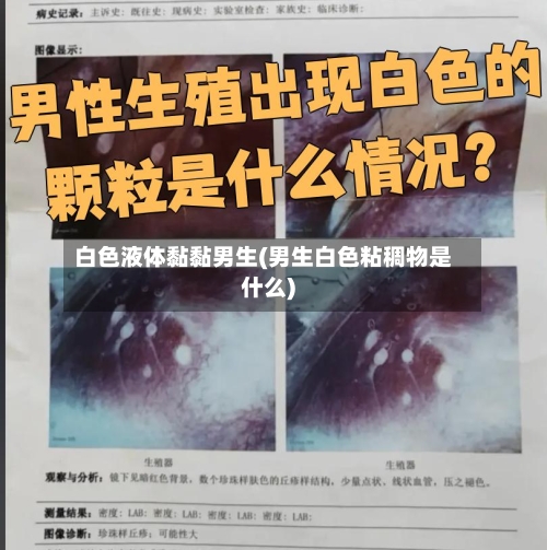 白色液体黏黏男生(男生白色粘稠物是什么)-第1张图片