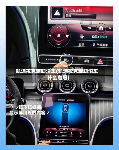 凯迪拉克辅助泊车(凯迪拉克辅助泊车什么意思)-第1张图片