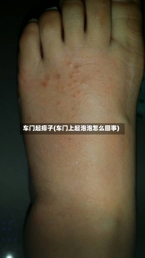 车门起痱子(车门上起泡泡怎么回事)-第3张图片