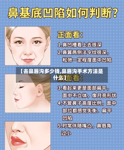 【去鼻唇沟多少钱,鼻唇沟手术方法是什么】-第1张图片