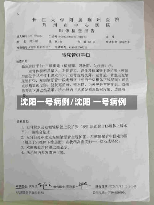 沈阳一号病例/沈阳 一号病例-第2张图片