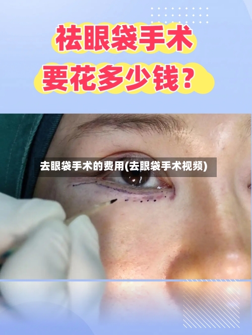去眼袋手术的费用(去眼袋手术视频)-第3张图片