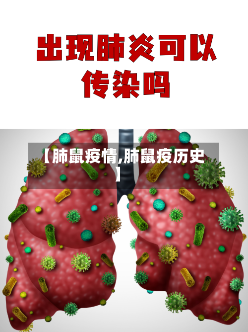 【肺鼠疫情,肺鼠疫历史】-第1张图片